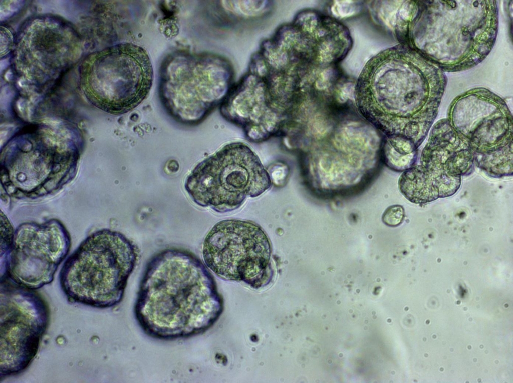 Mikroskopaufnahme von Organoiden als grüngraue Cluster