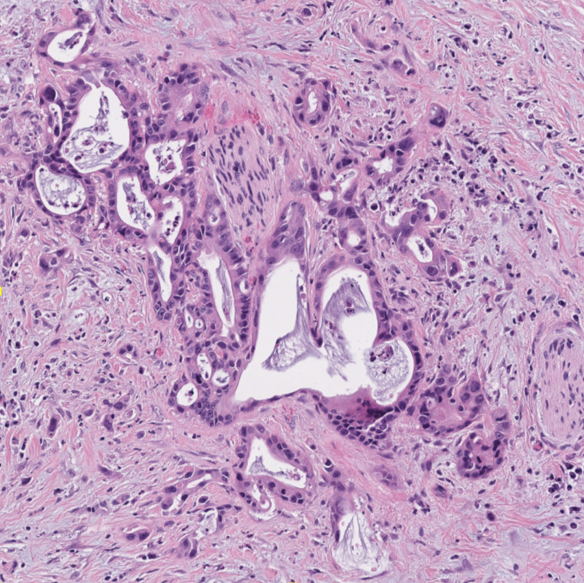 Histologischer Schnitt mit Zellarchitektur und Gewebedichte in Rosa- und Lilatönen